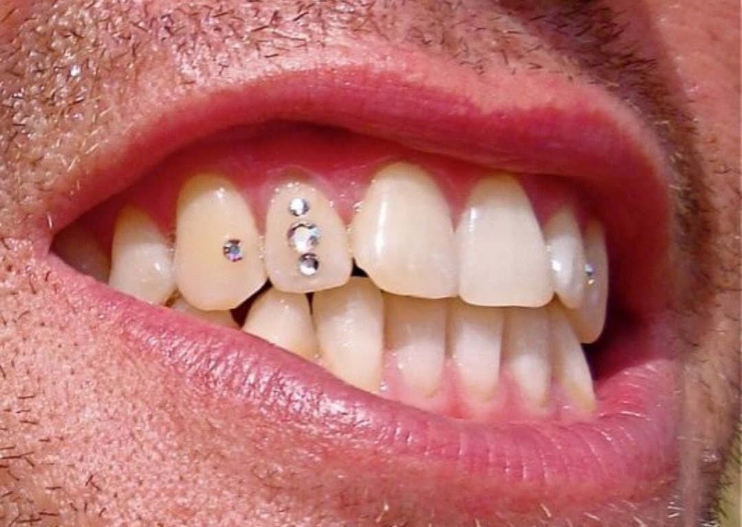 Swarovski Flatback Colored Rhinestones (Tooth Gems) –  - Teeth Whitening Products that Work!