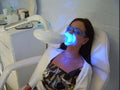 In Office Assisted Teeth Whitening