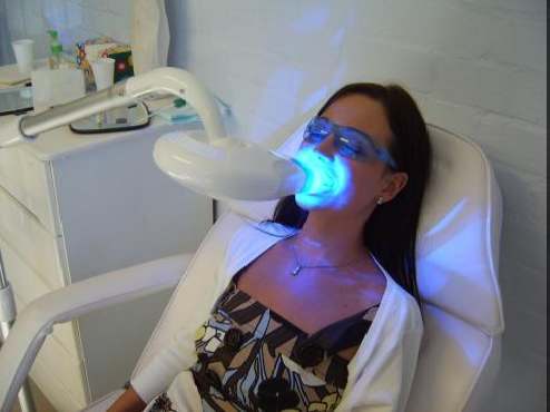In Office Assisted Teeth Whitening
