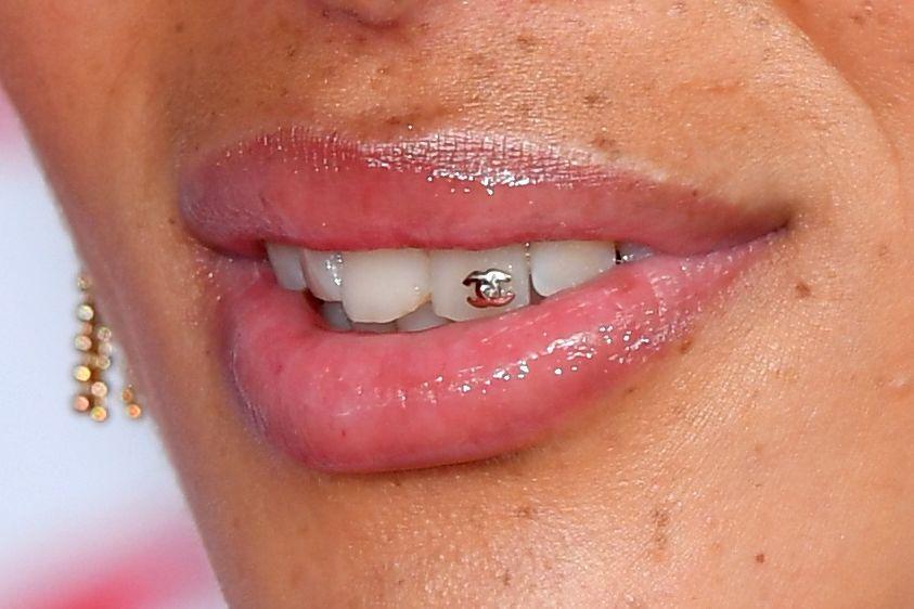Teeth Bling