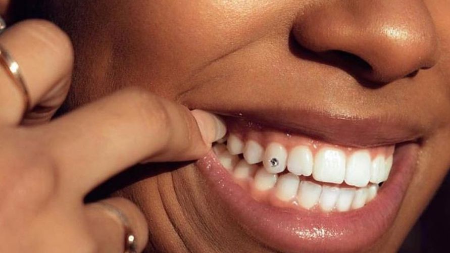 Teeth Bling