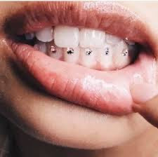 Teeth Bling