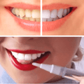 Whitening Pen